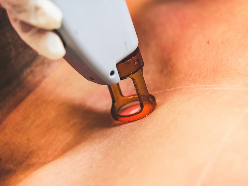Depilação a laser 4D